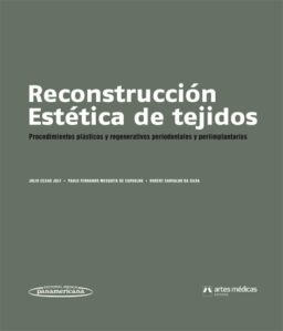 Reconstrucción Estética de tejidos. Procedimientos plásticos y regenerativos periodontales y periimplantarios
