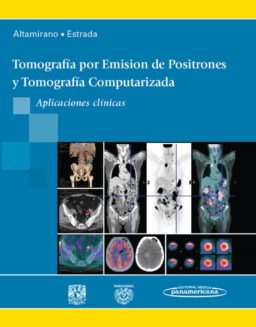 Tomografía por Emisión de Positrones y Tomografía Computarizada. Aplicaciones clínicas