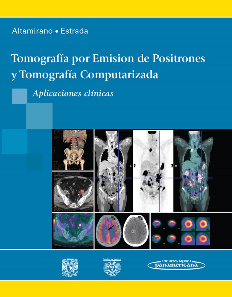 Tomografía por Emisión de Positrones y Tomografía Computarizada. Aplicaciones clínicas
