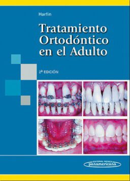 Tratamiento Ortodóntico en el Adulto.
