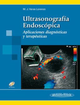 Ultrasonografía Endoscópica. Aplicaciones diagnósticas y terapéuticas