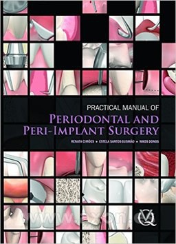 PRACTICAL MANUAL OF PERIODONTOLOGY AND PERIIMPLANTITIS