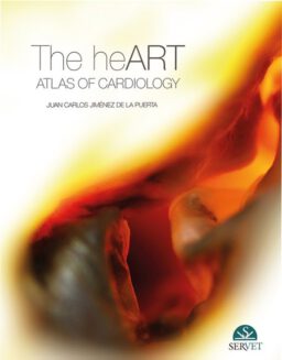 The Heart. Atlas of cardiology
