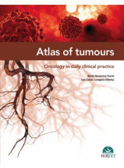 Atlas of tumours. Oncology in daily clinical practice