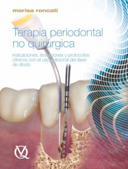 Terapia periodontal no quirúrgica