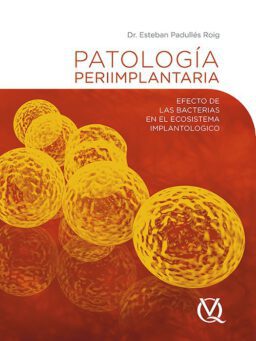 Patología periimplantaria. Efecto de las bacterias en el ecosistema implantologico