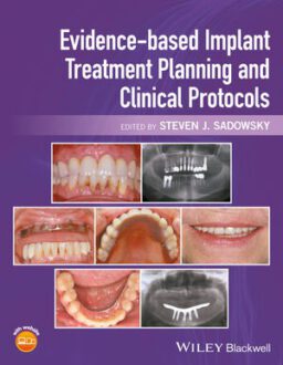 EVIDENCE-BASED IMPLANT TREATMENT PLANNING AND CLINICAL PROTOCOLS