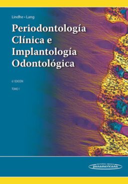 Periodontología Clínica e Implantología Odontológica (2 Tomos) Lindhe