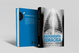 Atlas de radiografía torácica por razas caninas