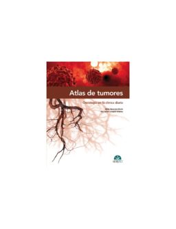 Atlas de tumores. Oncología en la clínica diaria