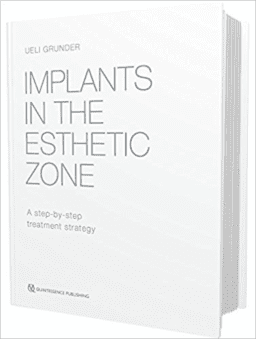 IMPLANTS IN THE ESTHETIC ZONE. A STEP-BY-STEP TREATMENT STRATEGY