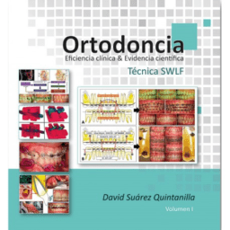 Ortodoncia. Eficiencia Clínica & Evidencia Científica. Técnica SWLF