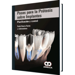 PASOS PARA LA PROTESIS SOBRE IMPLANTES. PLANIFICACION Y CONTROL