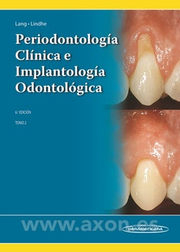 Periodontología Clínica e Implantología Odontológica. Tomo 2 - Conceptos Clínicos