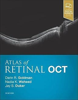 Atlas of Retinal OCT