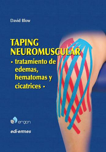 TAPING NEUROMUSCULAR . Tratamiento de edemas, hematomas y cicatrices