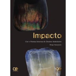 Impacto. Color y forma de los dientes anteriores