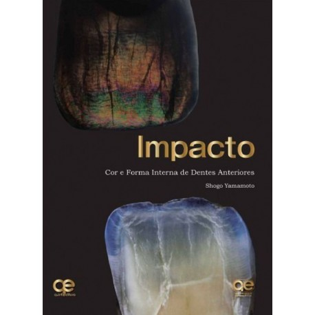 Impacto. Color y forma de los dientes anteriores