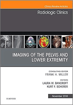 Imaging of the Pelvis and Lower Extremity (An Issue of Radiologic Clinics of North America, Vol. 56-6)