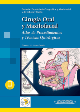 Cirugía Oral y Maxilofacial. Atlas de Procedimientos y Técnicas Quirúrgicas (Incluye E-Book)
