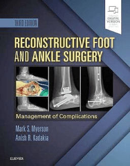 Reconstructive Foot and Ankle Surgery. Management of Complications (Print and Online)