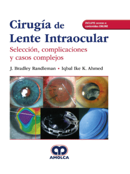 Cirugía de Lente Intraocular. Selección, Complicaciones y Casos Complejos + Acceso a Contenido Online