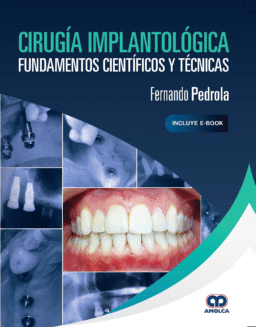 Cirugía Implantológica. Fundamentos Científicos y Técnicas (Incluye E-Book)