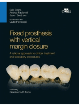 Fixed prosthesis with vertical margin closure