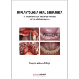Implantología Oral Geriátrica. El tratamiento con implantes dentales en los adultos mayores