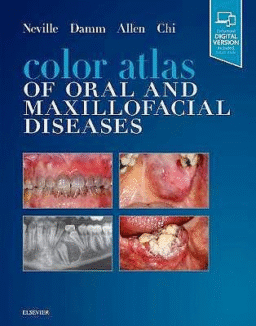 Color Atlas of Oral and Maxillofacial Diseases (Print and Online)