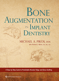 Bone Augmentation in Implant Dentistry: A Step-by-Step Guide to ...