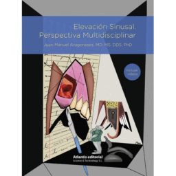Elevación Sinusal. Perspectiva Multidisciplinar