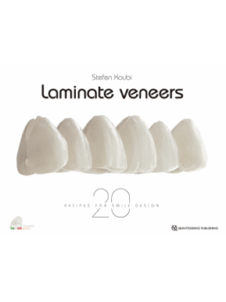 Laminate Veneer 20 Recipes for Smile Design