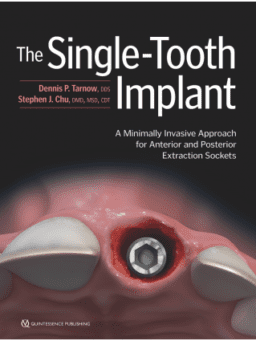 The Single-Tooth Implant A Minimally Invasive Approach for Anterior and Posterior Extraction Sockets