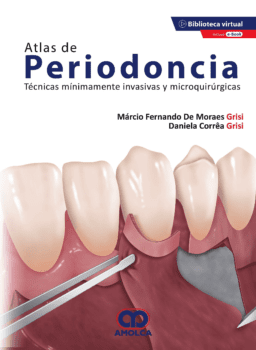 Atlas de Periodoncia. Técnicas Mínimamente Invasivas y Microquirúrgicas + E-Book