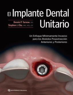 IMPLANTE DENTAL UNITARIO