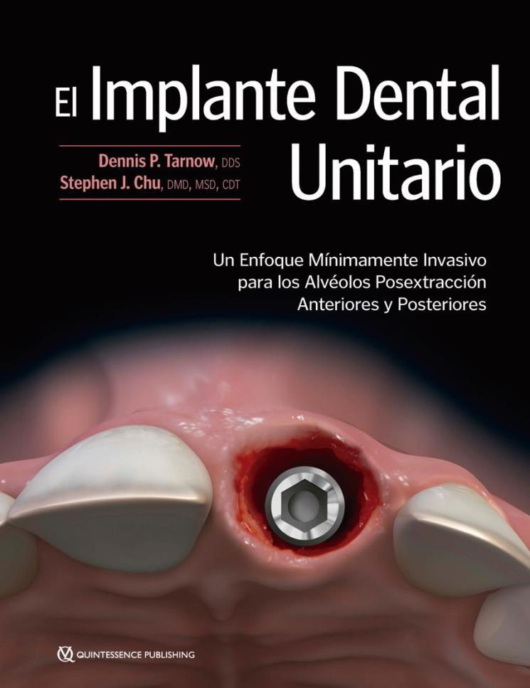 IMPLANTE DENTAL UNITARIO