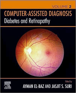 Diabetes and Retinopathy (Computer Assisted Diagnosis, Vol. 2)