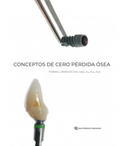 pérdida ósea