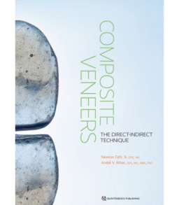 Composite Veneers. The Direct-Indirect Technique