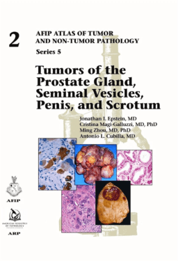Tumors of the Prostate Gland, Seminal Vesicles, Penis, and Scrotum (AFIP Atlas of Tumor and Non-tumor Pathology, S.5, Vol. 2)
