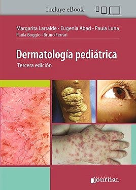 Dermatología Pediátrica (Incluye E-Book)