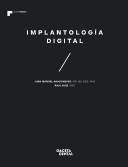 Implantología Digital