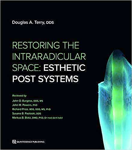 Restoring the Intraradicular Space. Esthetic Post Systems