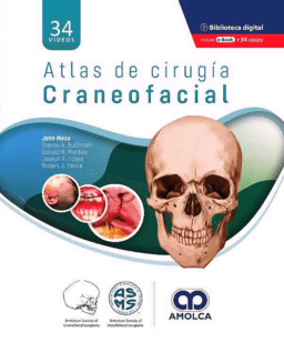 Atlas de Cirugía Craneofacial (Incluye 34 Videos)