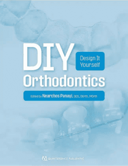 DIY Orthodontics. Design It Yourself