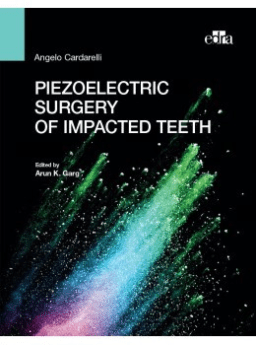 Piezoelectric surgery of impacted teeth
