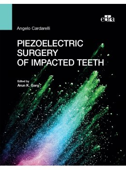 Piezoelectric surgery of impacted teeth