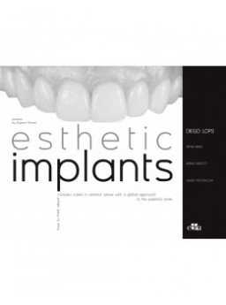 Esthetic Implants: How to think about complex cases in anterior areas with a global approach to the patient smile
