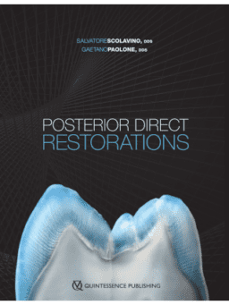POSTERIOR DIRECT RESTORATIONS